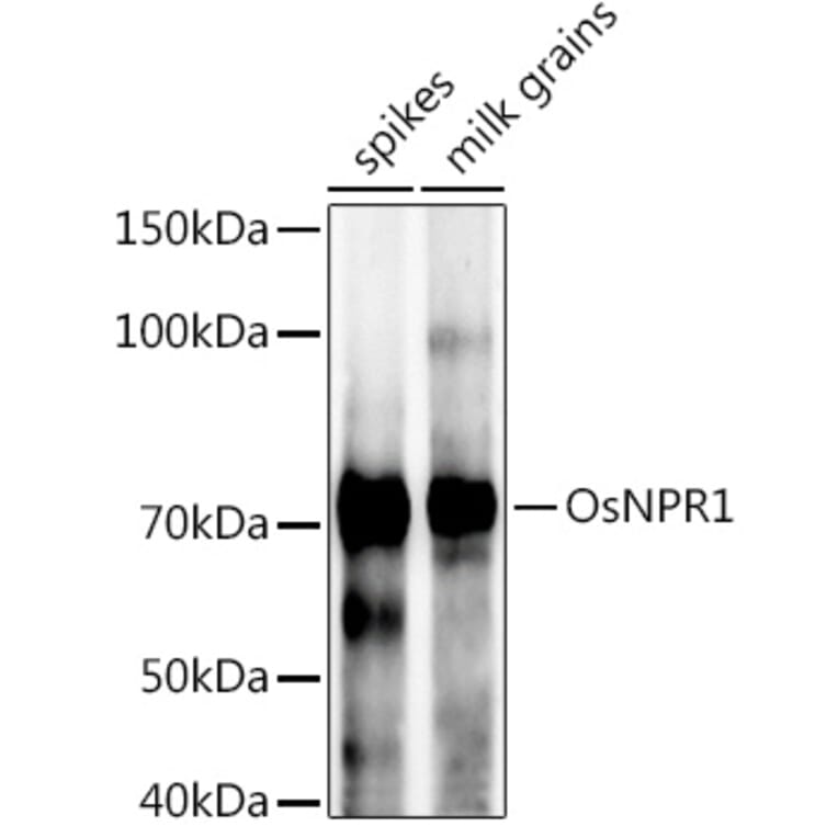 Western Blot - Anti-NPR1 Antibody (A309834) - Antibodies.com