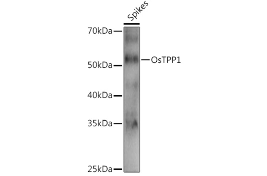 Western Blot - Anti-TPP1 Antibody (A309838) - Antibodies.com