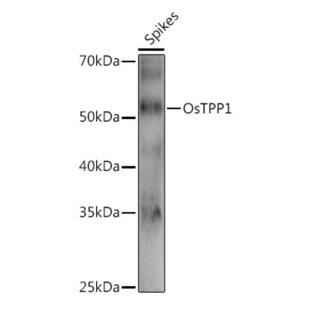 Western Blot - Anti-TPP1 Antibody (A309838) - Antibodies.com