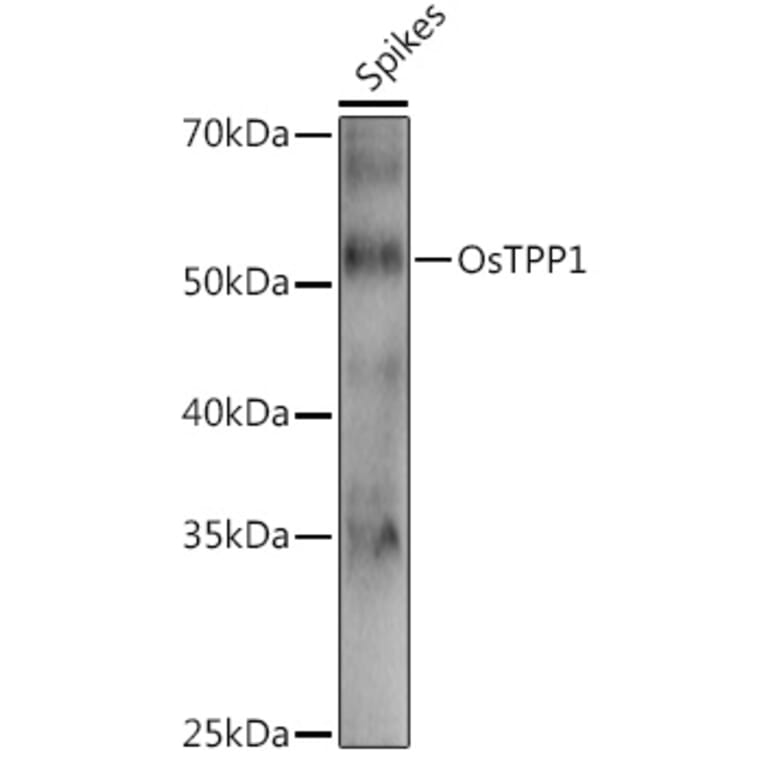 Western Blot - Anti-TPP1 Antibody (A309838) - Antibodies.com