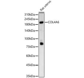 Western Blot - Anti-Collagen IV alpha 6 Antibody (A309843) - Antibodies.com