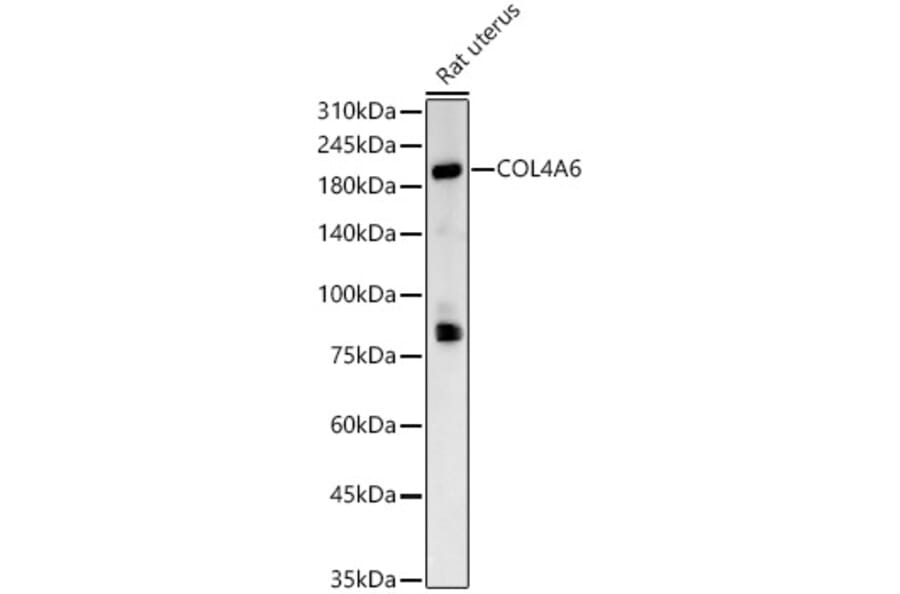 Western Blot - Anti-Collagen IV alpha 6 Antibody (A309843) - Antibodies.com