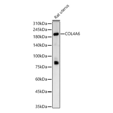 Western Blot - Anti-Collagen IV alpha 6 Antibody (A309843) - Antibodies.com