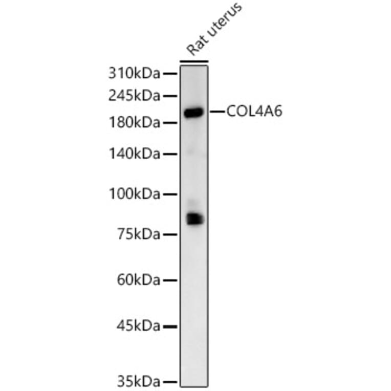 Western Blot - Anti-Collagen IV alpha 6 Antibody (A309843) - Antibodies.com