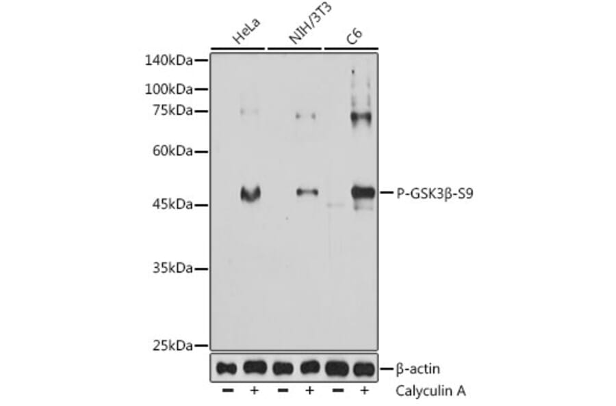 Western Blot - Anti-GSK3 beta (Phospho S9) Antibody [AMC0523] (A309844) - Antibodies.com