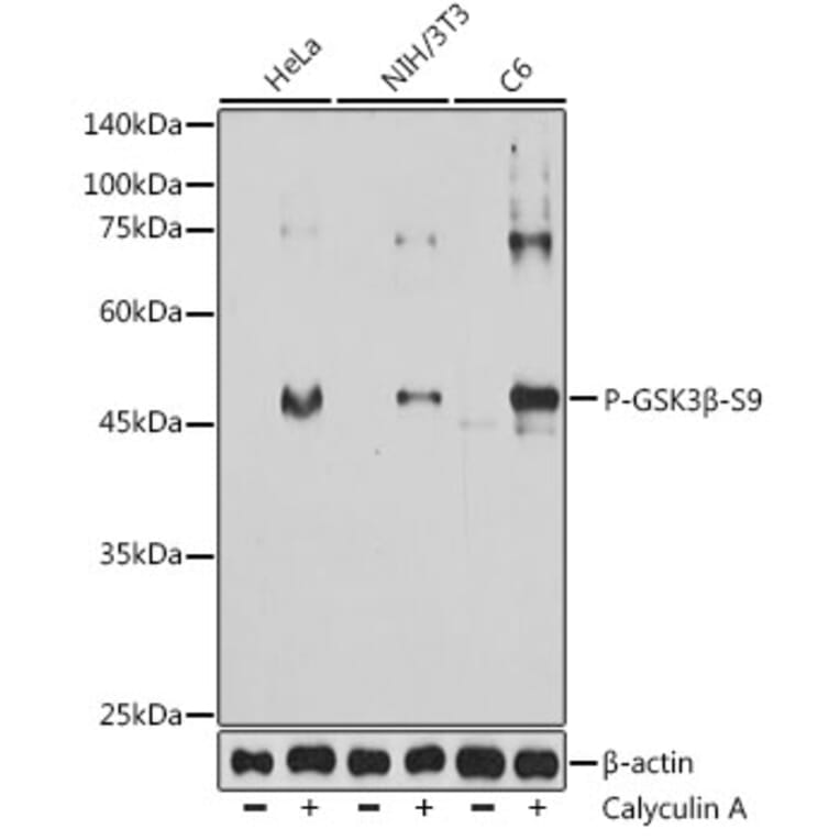 Western Blot - Anti-GSK3 beta (Phospho S9) Antibody [AMC0523] (A309844) - Antibodies.com