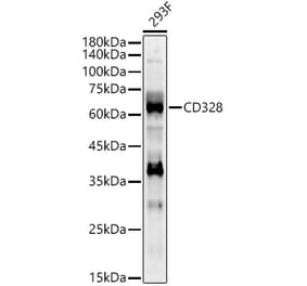 Western Blot - Anti-Siglec 7 Antibody (A309849) - Antibodies.com
