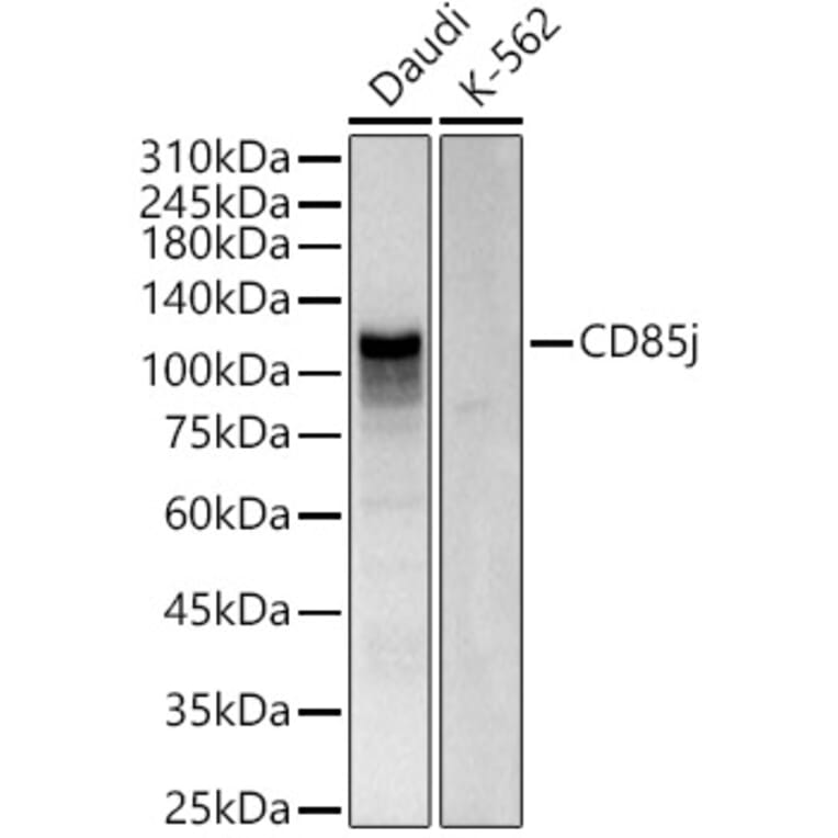 Western Blot - Anti-LILRB1 Antibody (A309851) - Antibodies.com