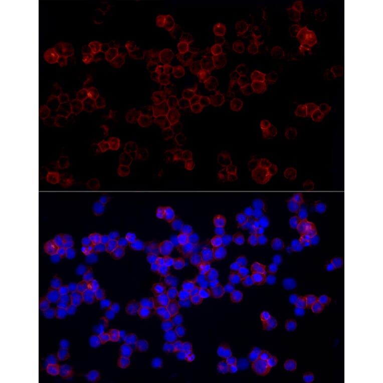 Immunofluorescence - Anti-LILRB1 Antibody (A309851) - Antibodies.com