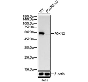 Western Blot - Anti-FOXN2 Antibody [ARC58450] (A309852) - Antibodies.com