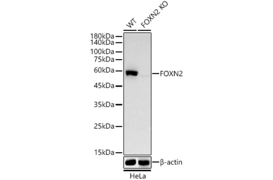 Western Blot - Anti-FOXN2 Antibody [ARC58450] (A309852) - Antibodies.com