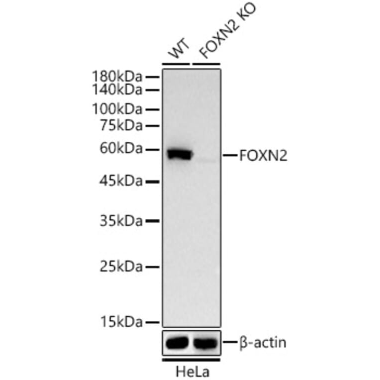 Western Blot - Anti-FOXN2 Antibody [ARC58450] (A309852) - Antibodies.com