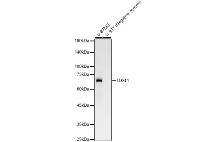 Western Blot - Anti-LOXL1 Antibody [ARC58135] (A309853) - Antibodies.com