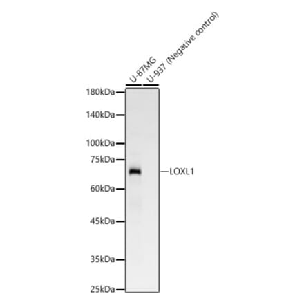 Western Blot - Anti-LOXL1 Antibody [ARC58135] (A309853) - Antibodies.com