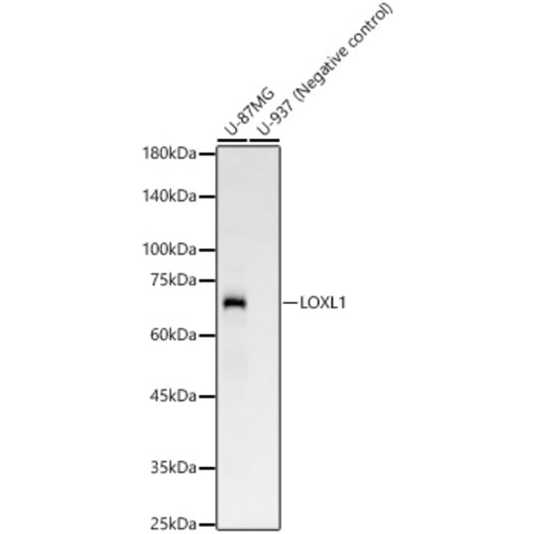 Western Blot - Anti-LOXL1 Antibody [ARC58135] (A309853) - Antibodies.com