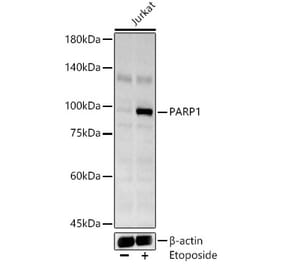 Western Blot - Anti-PARP1 Antibody (A309854) - Antibodies.com