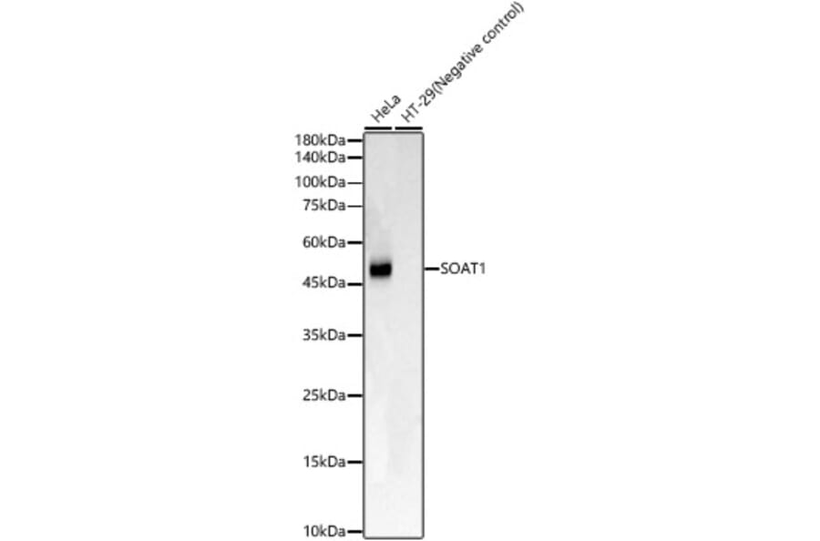 Western Blot - Anti-SOAT 1/ACAT1 Antibody [ARC59877] (A309855) - Antibodies.com