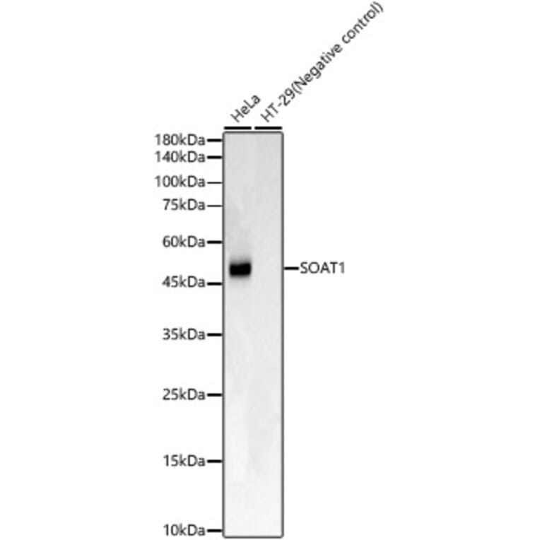 Western Blot - Anti-SOAT 1/ACAT1 Antibody [ARC59877] (A309855) - Antibodies.com