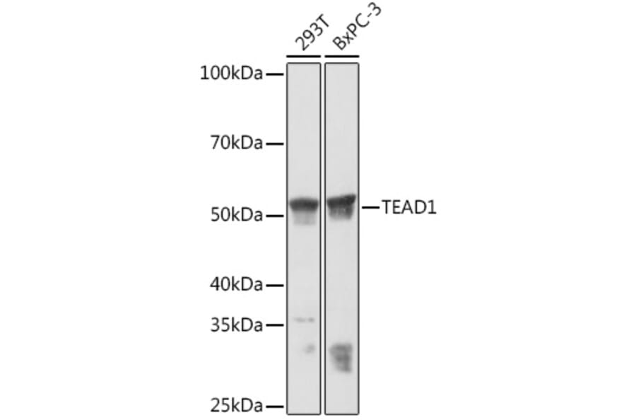 Western Blot - Anti-TEF1/TEAD-1 + TEA domain family member 2/ETF + TEAD3 + TEAD4 Antibody [ARC1158] (A309856) - Antibodies.com