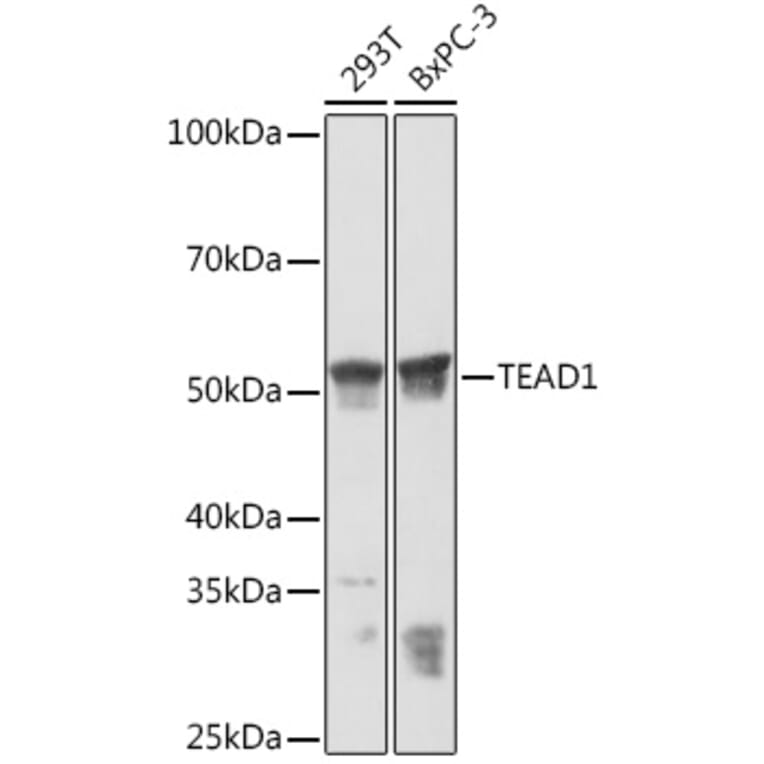 Western Blot - Anti-TEF1/TEAD-1 + TEA domain family member 2/ETF + TEAD3 + TEAD4 Antibody [ARC1158] (A309856) - Antibodies.com