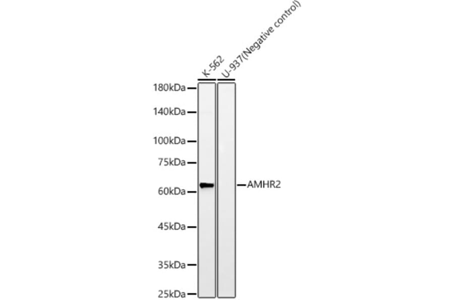 Western Blot - Anti-AMHR2 Antibody [ARC59094] (A309857) - Antibodies.com