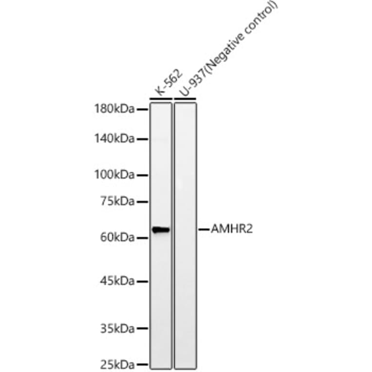 Western Blot - Anti-AMHR2 Antibody [ARC59094] (A309857) - Antibodies.com