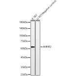 Western Blot - Anti-AMHR2 Antibody [ARC59094] (A309857) - Antibodies.com