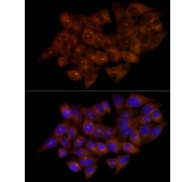 Immunofluorescence - Anti-FGFR1 Oncogene Partner Antibody [ARC2913] (A309858) - Antibodies.com