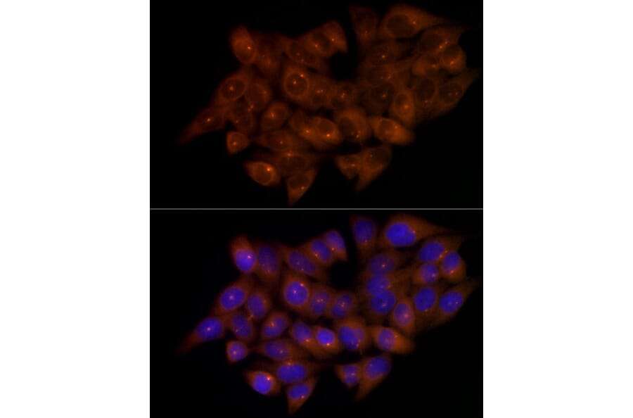 Immunofluorescence - Anti-FGFR1 Oncogene Partner Antibody [ARC2913] (A309858) - Antibodies.com