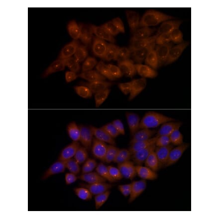 Immunofluorescence - Anti-FGFR1 Oncogene Partner Antibody [ARC2913] (A309858) - Antibodies.com