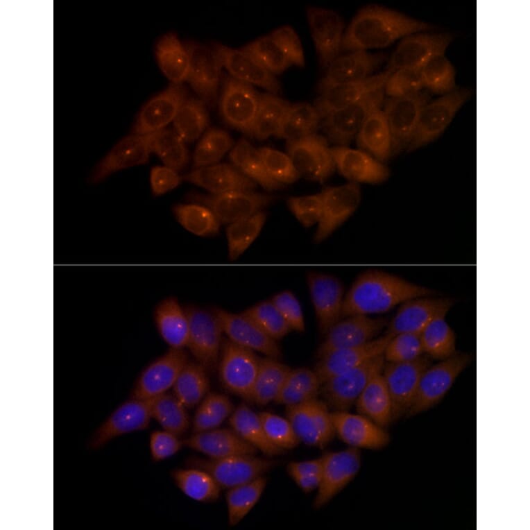 Immunofluorescence - Anti-FGFR1 Oncogene Partner Antibody [ARC2913] (A309858) - Antibodies.com
