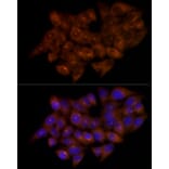 Immunofluorescence - Anti-FGFR1 Oncogene Partner Antibody [ARC2913] (A309858) - Antibodies.com