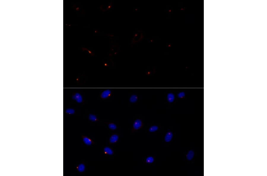 Immunofluorescence - Anti-FGFR1 Oncogene Partner Antibody [ARC2913] (A309858) - Antibodies.com