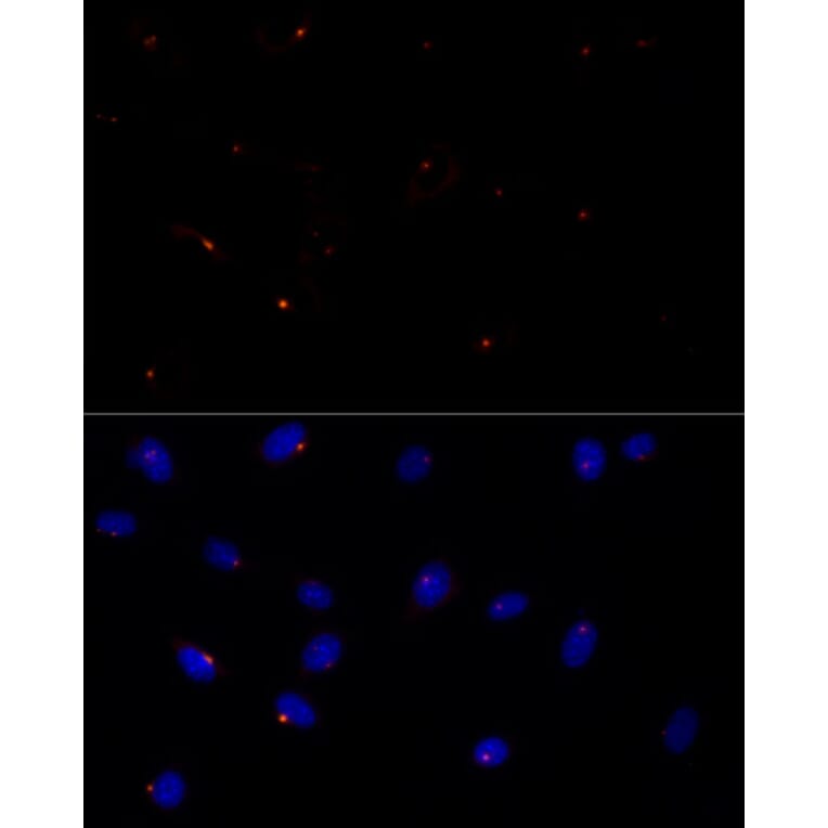 Immunofluorescence - Anti-FGFR1 Oncogene Partner Antibody [ARC2913] (A309858) - Antibodies.com