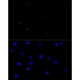 Immunofluorescence - Anti-FGFR1 Oncogene Partner Antibody [ARC2913] (A309858) - Antibodies.com