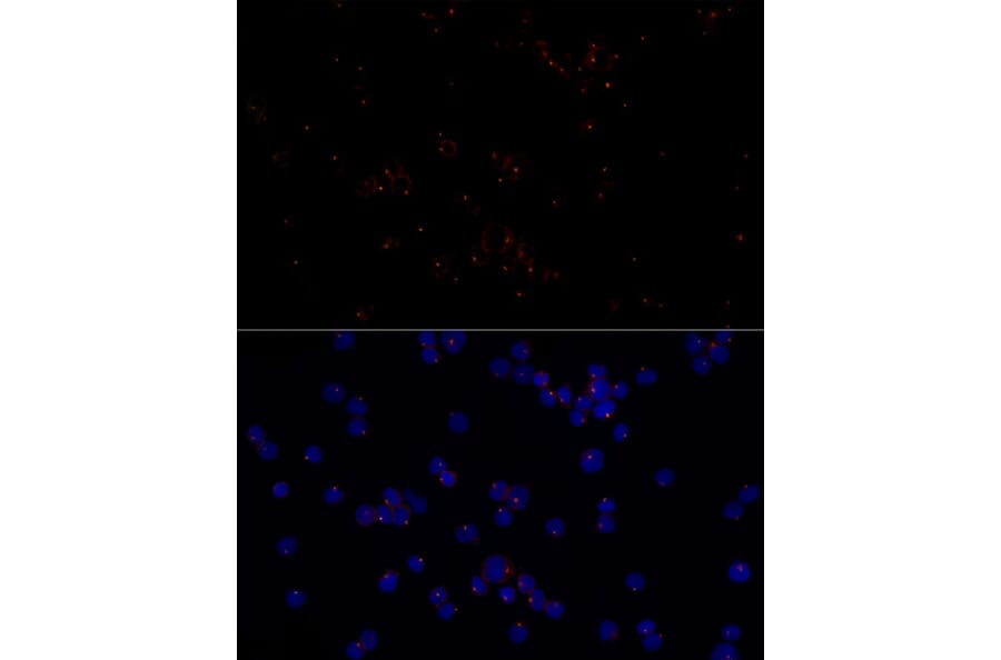 Immunofluorescence - Anti-FGFR1 Oncogene Partner Antibody [ARC2913] (A309858) - Antibodies.com