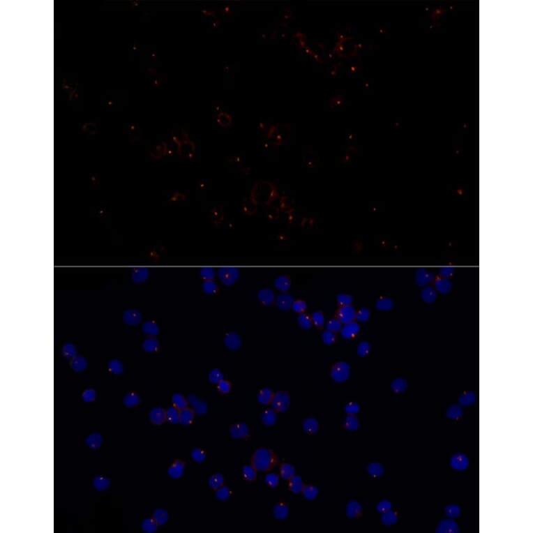Immunofluorescence - Anti-FGFR1 Oncogene Partner Antibody [ARC2913] (A309858) - Antibodies.com