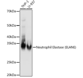Western Blot - Anti-Neutrophil Elastase Antibody [ARC1364] (A309860) - Antibodies.com