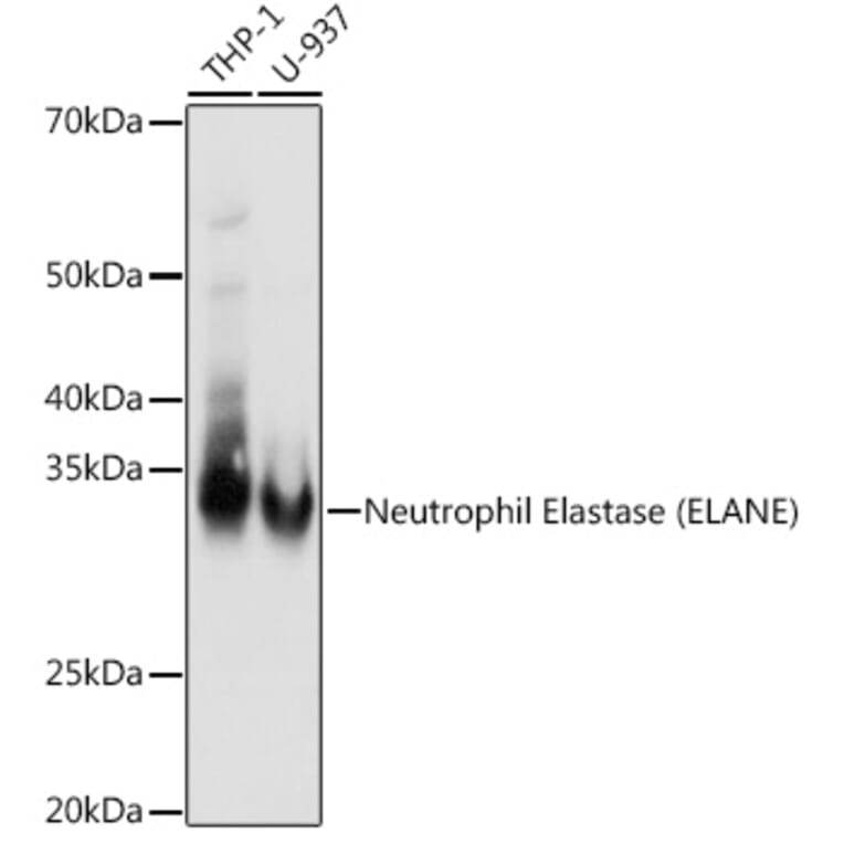 Western Blot - Anti-Neutrophil Elastase Antibody [ARC1364] (A309860) - Antibodies.com