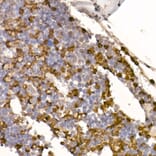 Immunohistochemistry - Anti-Neutrophil Elastase Antibody [ARC1364] (A309860) - Antibodies.com