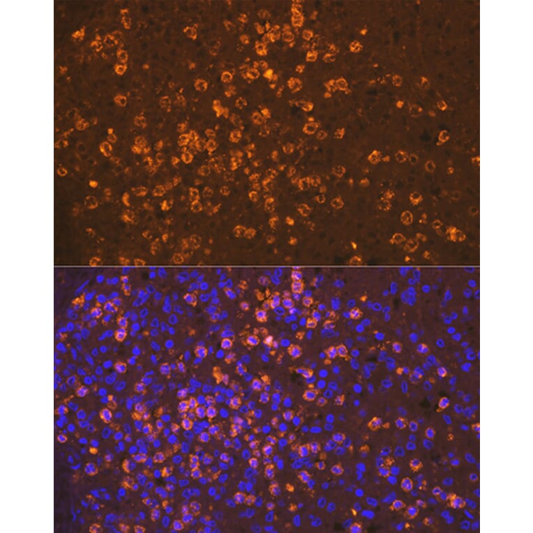 Immunofluorescence - Anti-Neutrophil Elastase Antibody [ARC1364] (A309860) - Antibodies.com