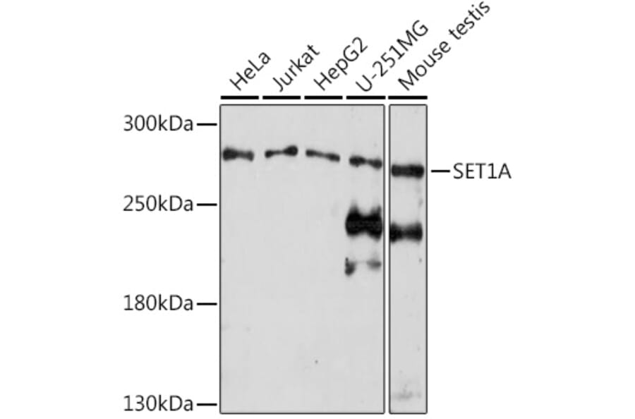 Western Blot - Anti-hSET1/SET1 Antibody (A309861) - Antibodies.com