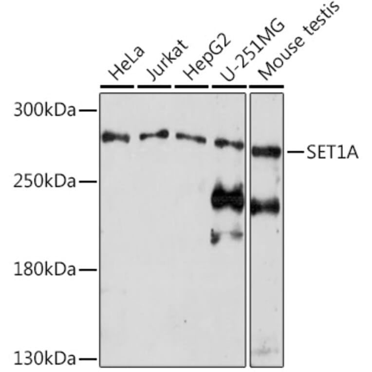 Western Blot - Anti-hSET1/SET1 Antibody (A309861) - Antibodies.com