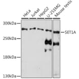 Western Blot - Anti-hSET1/SET1 Antibody (A309861) - Antibodies.com