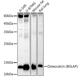 Western Blot - Anti-Osteocalcin Antibody [ARC51116] (A309865) - Antibodies.com
