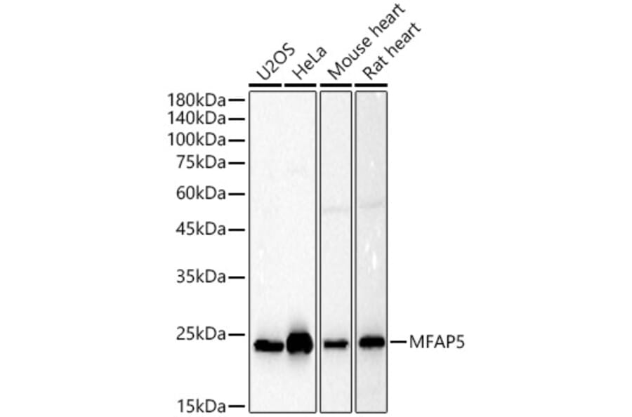 Western Blot - Anti-MAGP2 Antibody (A309868) - Antibodies.com