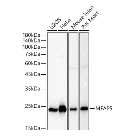 Western Blot - Anti-MAGP2 Antibody (A309868) - Antibodies.com