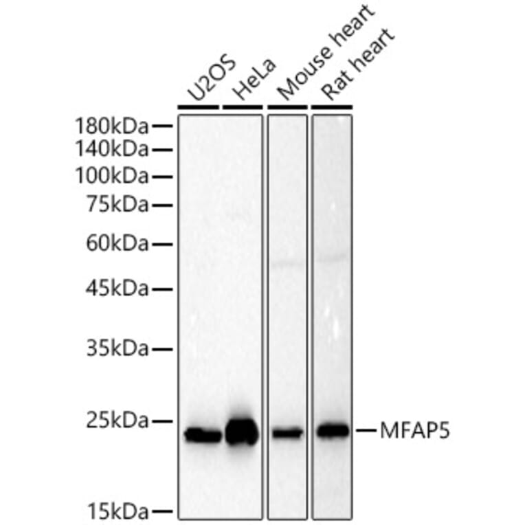 Western Blot - Anti-MAGP2 Antibody (A309868) - Antibodies.com