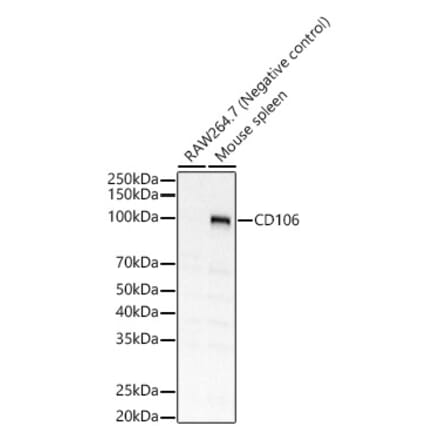 Western Blot - Anti-VCAM1 Antibody (A309878) - Antibodies.com