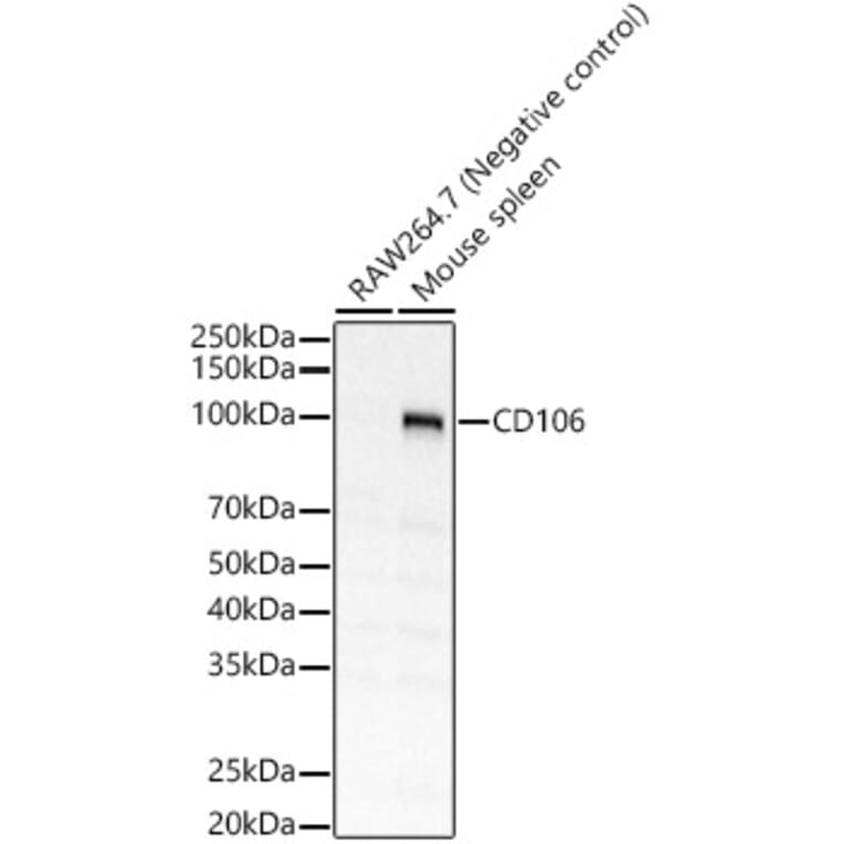 Western Blot - Anti-VCAM1 Antibody (A309878) - Antibodies.com